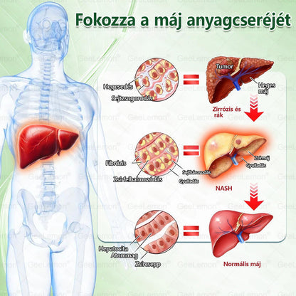 Ajánlott a Semmelweis Kórház által · 👩‍⚕️BENU hivatalos üzlet| 🎄✅ 𝐆𝐞𝑒𝐿𝑒𝐦𝐨𝐧® Glumasetide 8 az 1-ben Karcsú és Egészséges Nano Mikrotűs Tapasz 🇭🇺