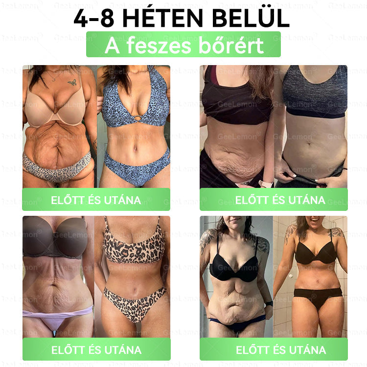 Ajánlott a Semmelweis Kórház által · 👩‍⚕️BENU hivatalos üzlet| 🎄✅ 𝐆𝐞𝑒𝐿𝑒𝐦𝐨𝐧® Glumasetide 8 az 1-ben Karcsú és Egészséges Nano Mikrotűs Tapasz 🇭🇺